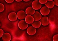 Właściwości i wybrane metody oznaczania stężenia hemoglobiny cz.II
