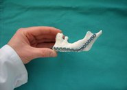 W Rzeszowie wydrukowano żuchwę w 3D
