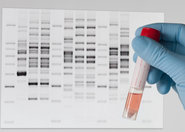 Metody sekwencjonowania DNA