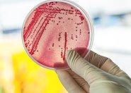 Antybiotyki sprzyjają rozmnażaniu bakterii