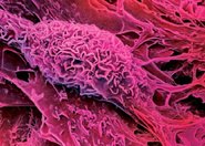 Usprawnianie gojenia się urazów poprzez osadzanie komórek macierzystych