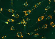 Fluorescencyjne sondy wykryją jony cynku w komórkach
